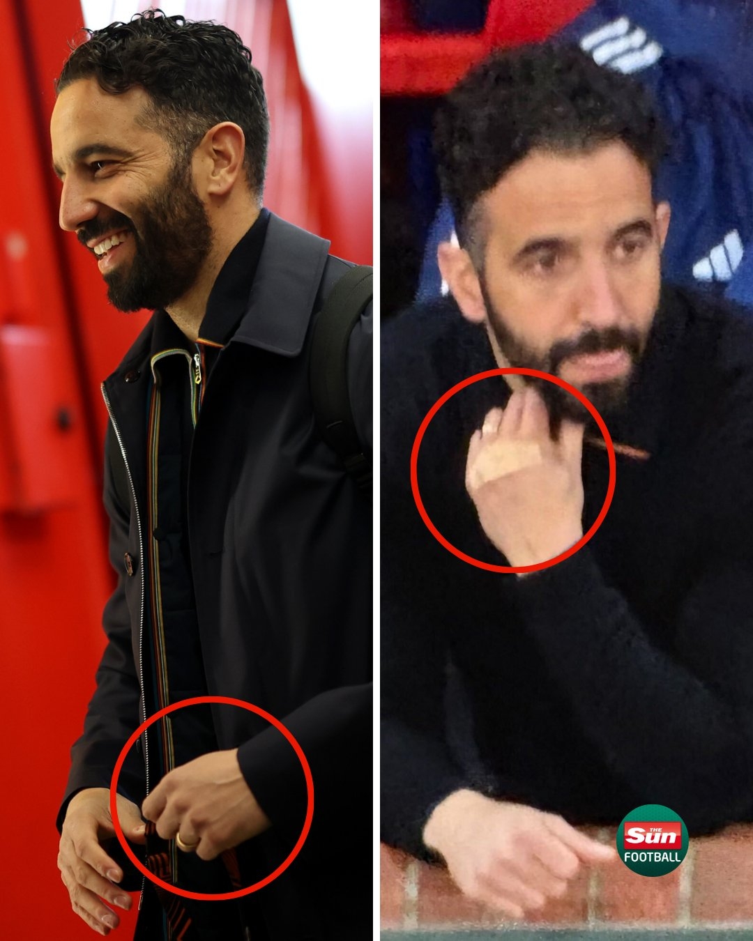 又有东西遭殃？阿莫林中场休息后指关节贴绷带，曾干碎更衣室电视